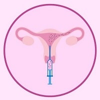 сурогатное материнство для пар и одиноких